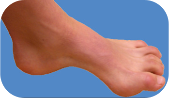 Quelle chaussure de running pour pied creux